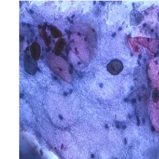 Pipeline microscopy image