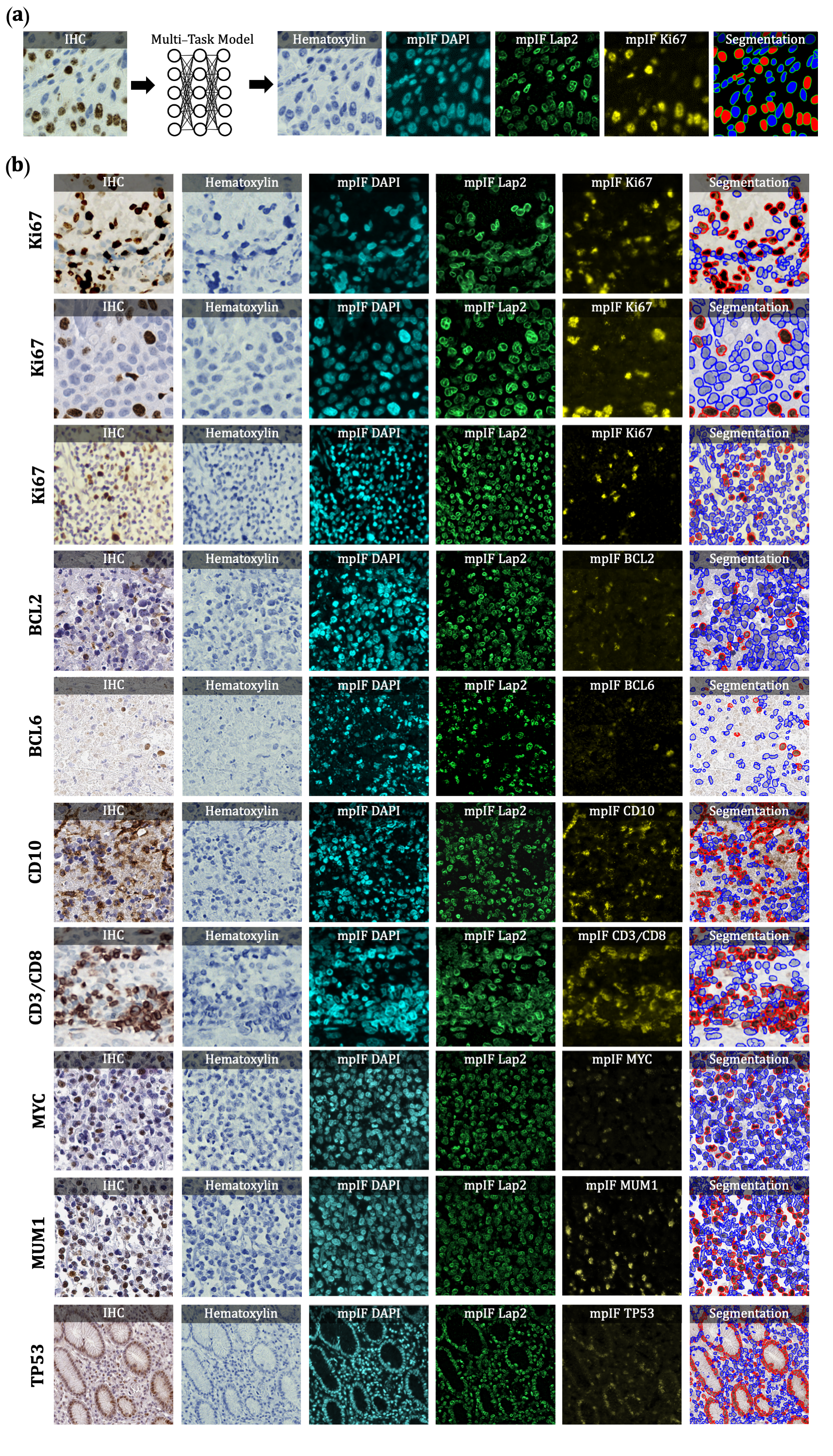 Virtual multiplex staining and segmentation overview