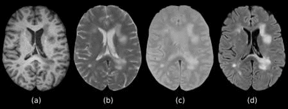 Full sequence strip showing T1, T2, contrast-enhanced T1 and FLAIR MRI