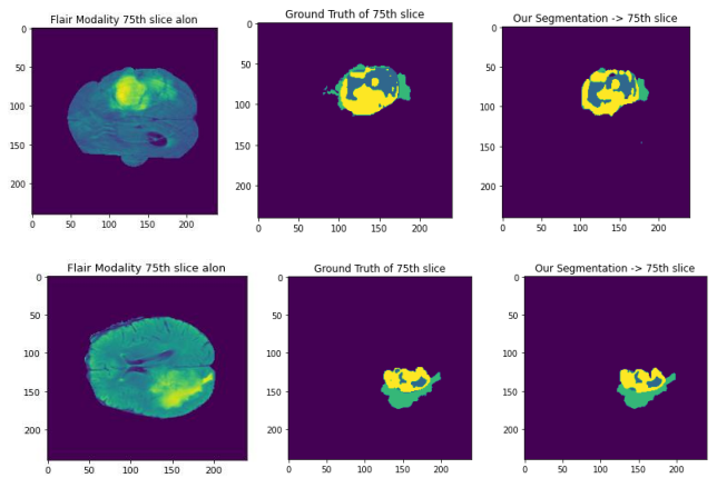 Brain MRI, ground-truth masks and model segmentation results