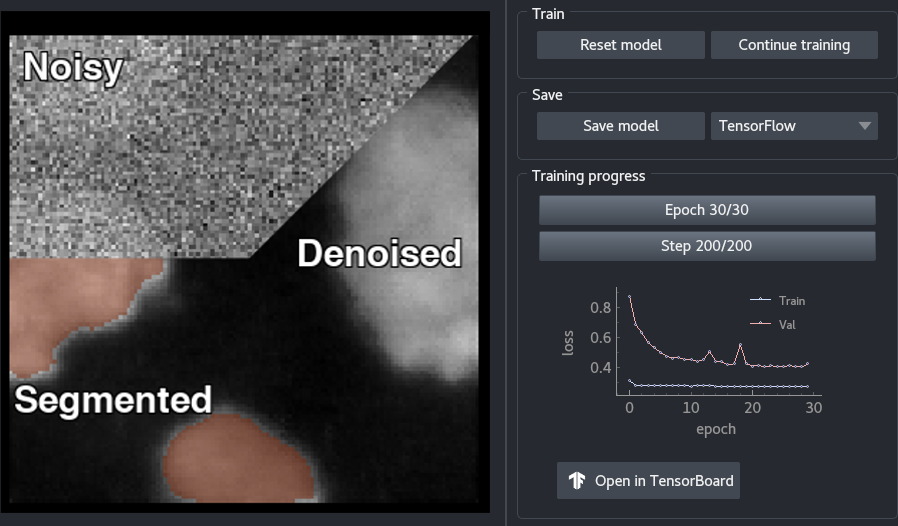 Microscopy denoising and segmentation workbench