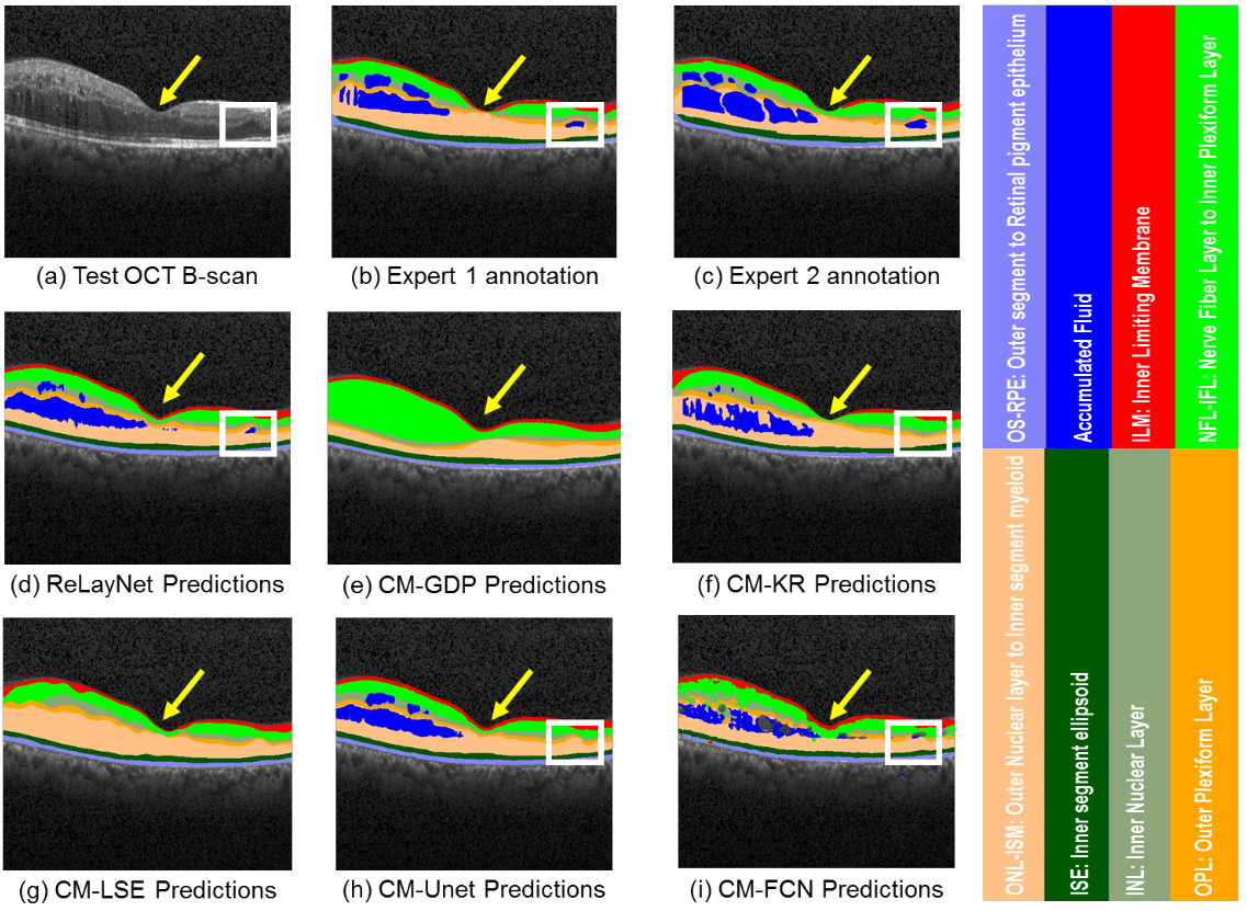 Retinal layer segmentation comparison across expert annotations and prediction methods