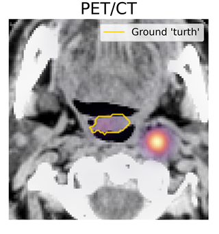 PET CT ground truth