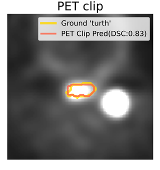 PET clip prediction