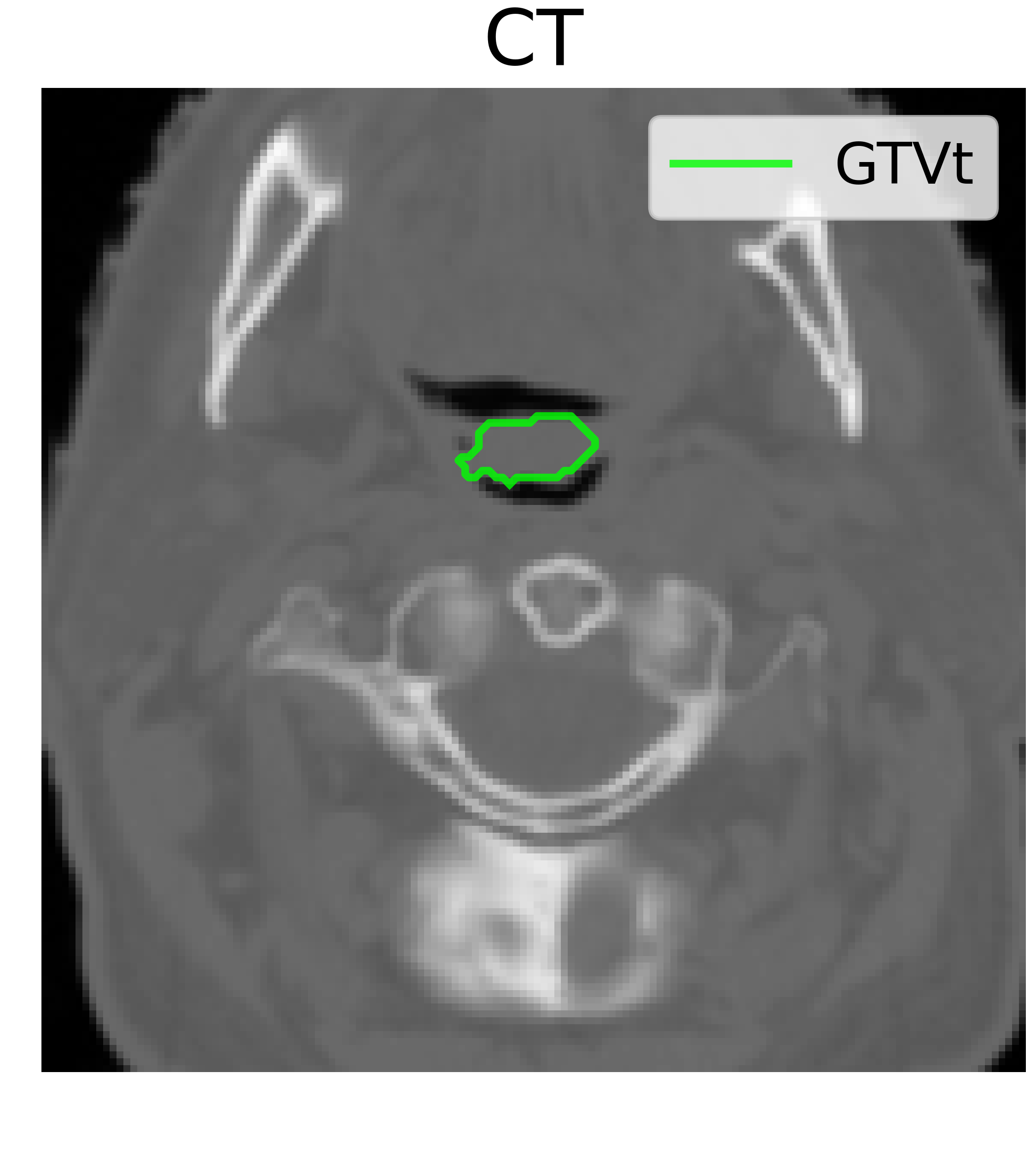 CT modality image