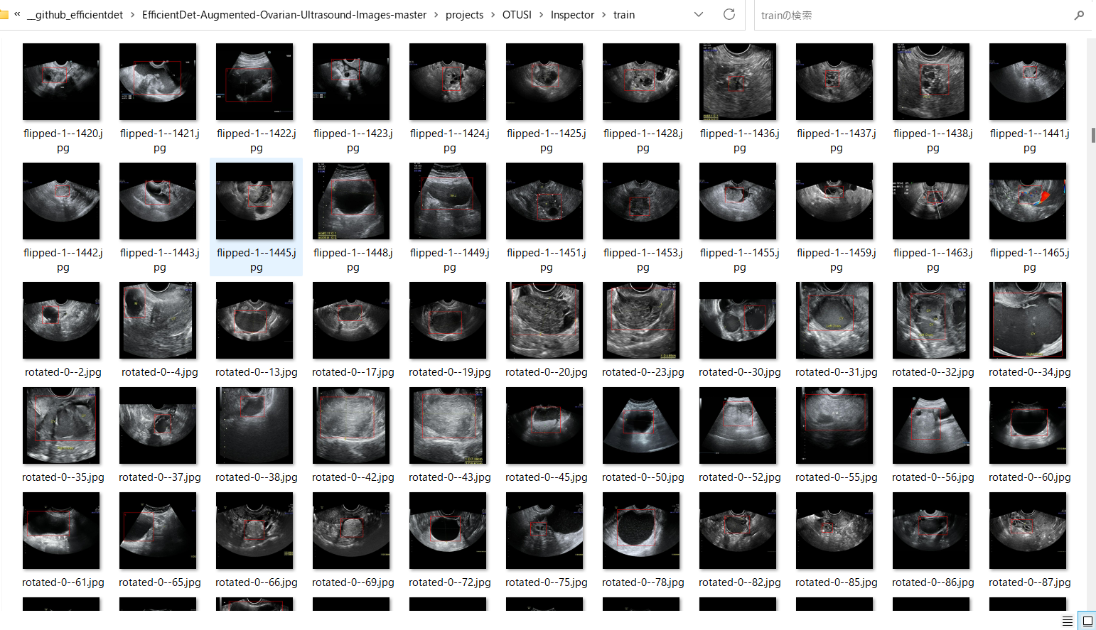 Augmented ovarian ultrasound dataset contact sheet
