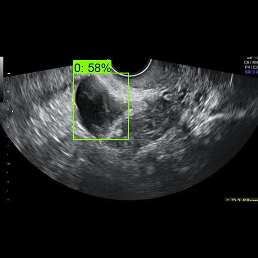 Animated ovarian ultrasound dataset example