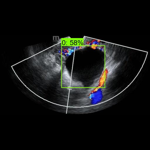 Detection result